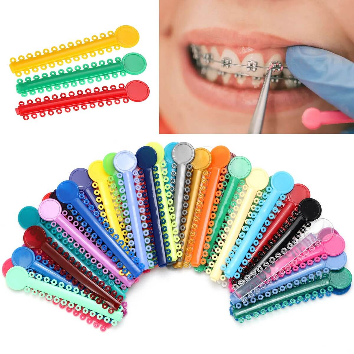 Dental Ties Ligatures